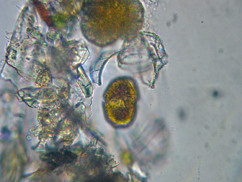 Dinoflagellato ?